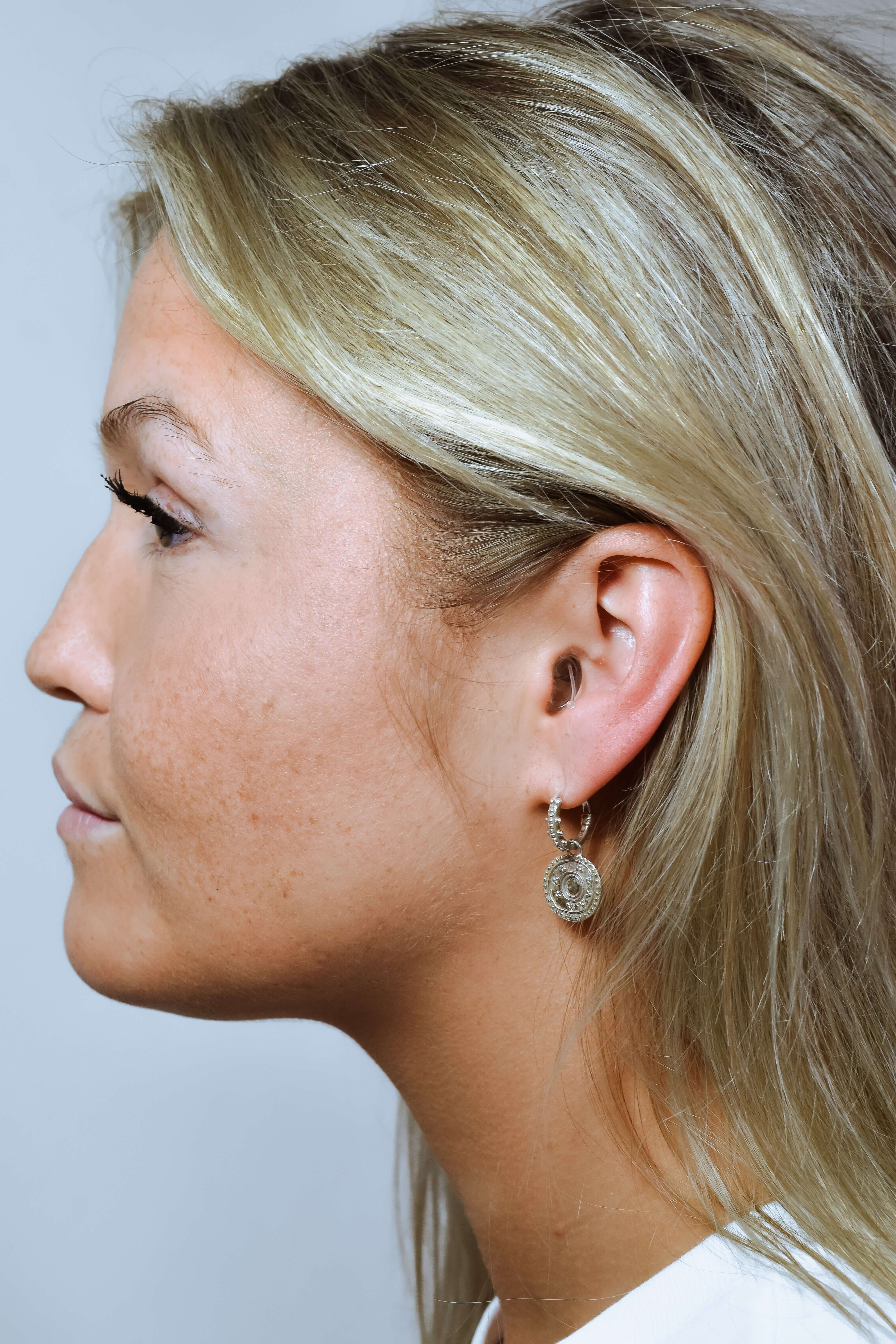 Earasers Sensory dopuri urechi M -19dB hipersensibilitate